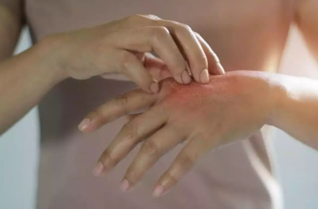 오미크론의 증상 VIDEO: What are the symptoms of Omicron?