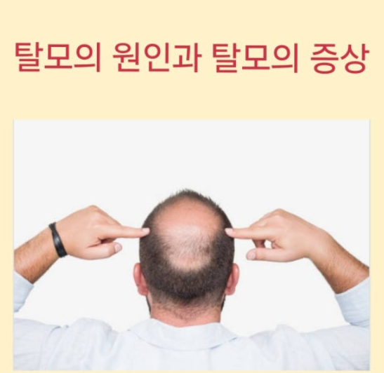 탈모