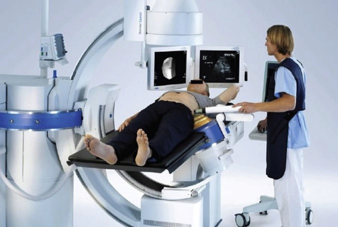 체외충격파쇄석술 과정 