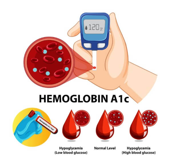 채혈을 통해 혈당을 재고 혈액 속 성분을 분석하는 모습