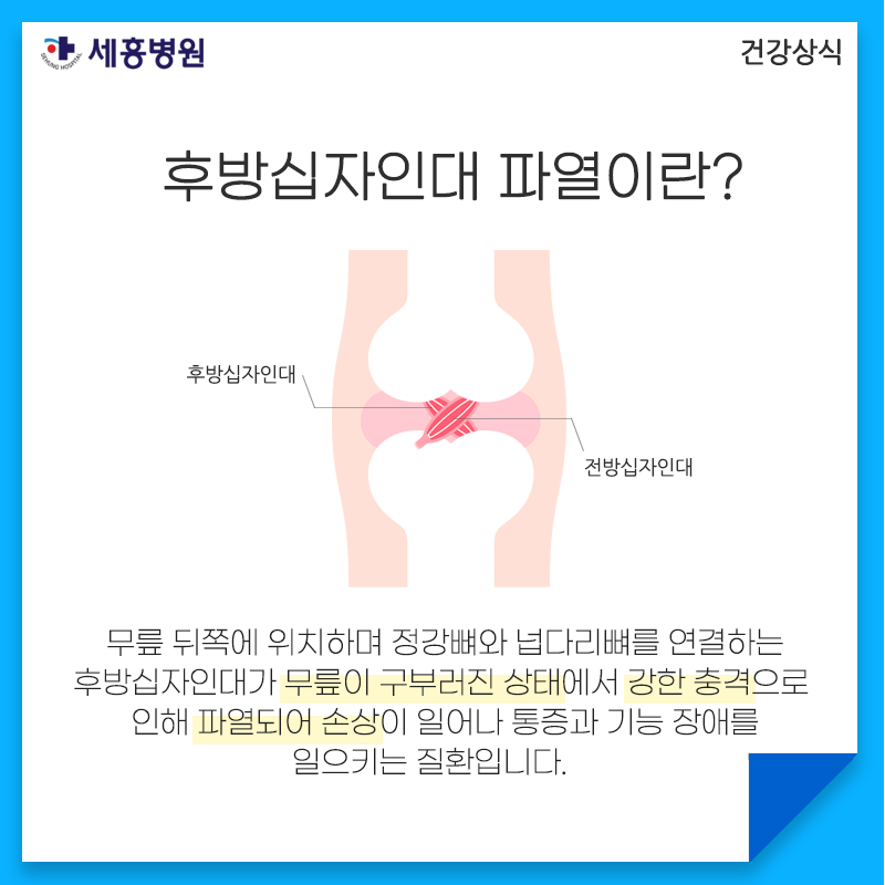 무릎십자인대파열