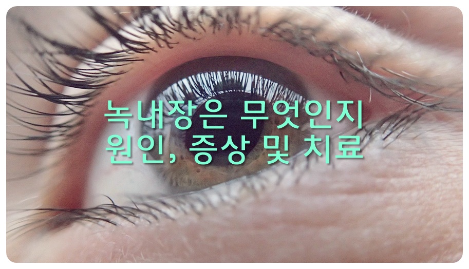 녹내장은 무엇인지, 원인, 증상 및 치료