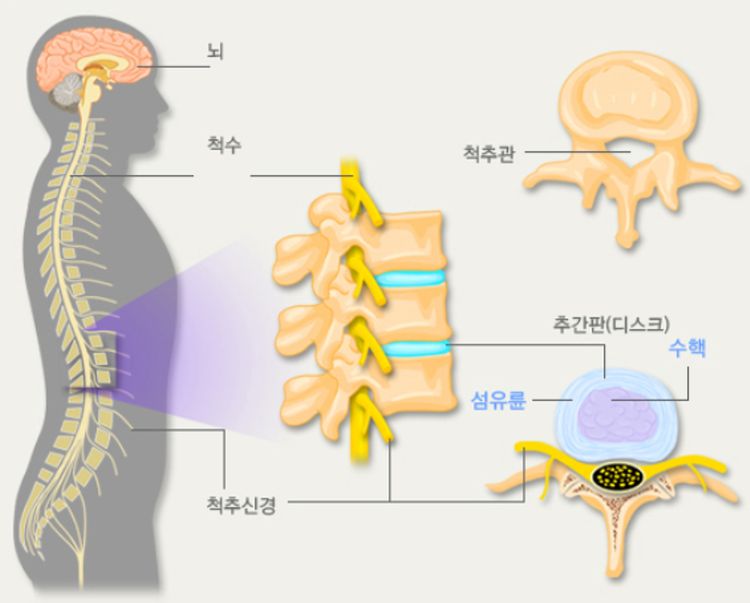 좌골신경통 증상