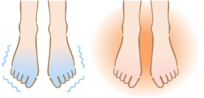 발이 후끈후끈 차가워지는 이유