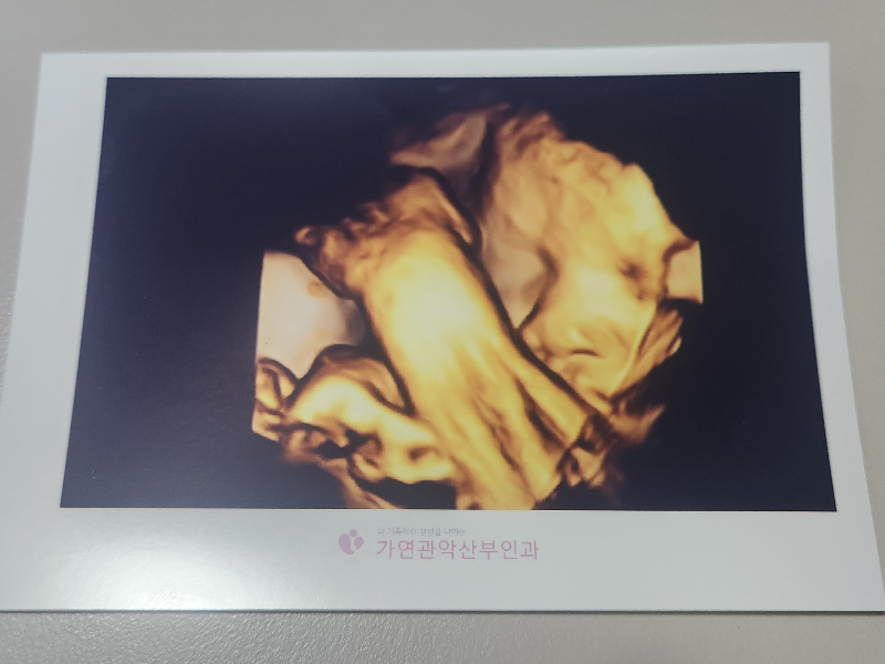 35주 초음파사진