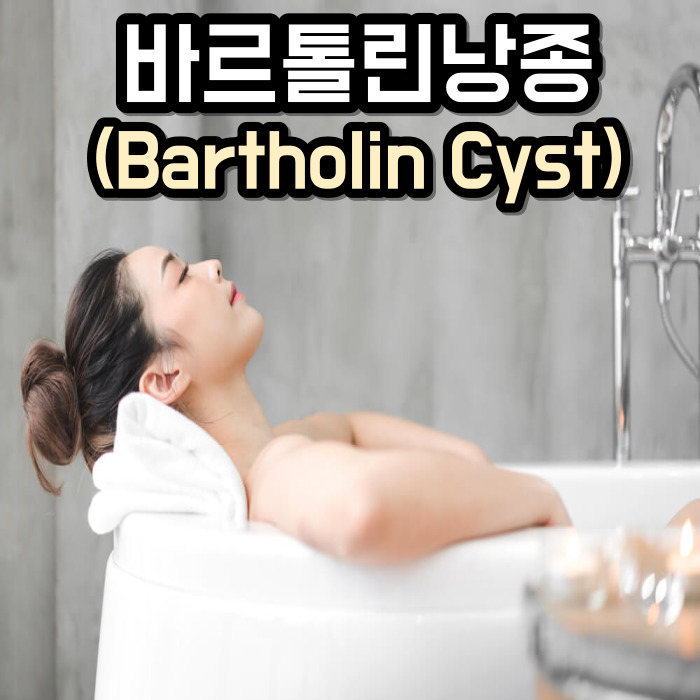 바르톨린낭종 자연치유
바르톨린 낭종 자연치유
