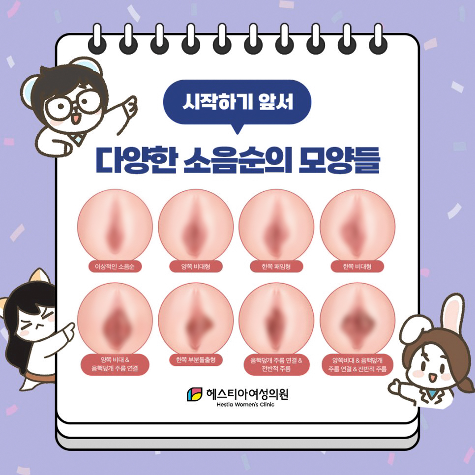 다양한 소음순의 모양들