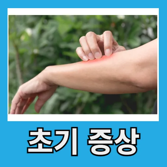 말라리아 모기 물리면 피부 초기 증상