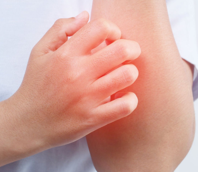 목디스크 증상 치료 방법 팔저림 운동 요법 수술 시술 종류 원인