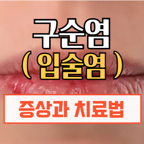 구순염(입술염) 원인과 치료법