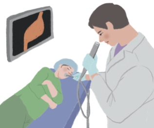 스트레스성 위염