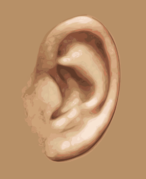 귓볼에 주름&middot;귓볼에 대각선 주름