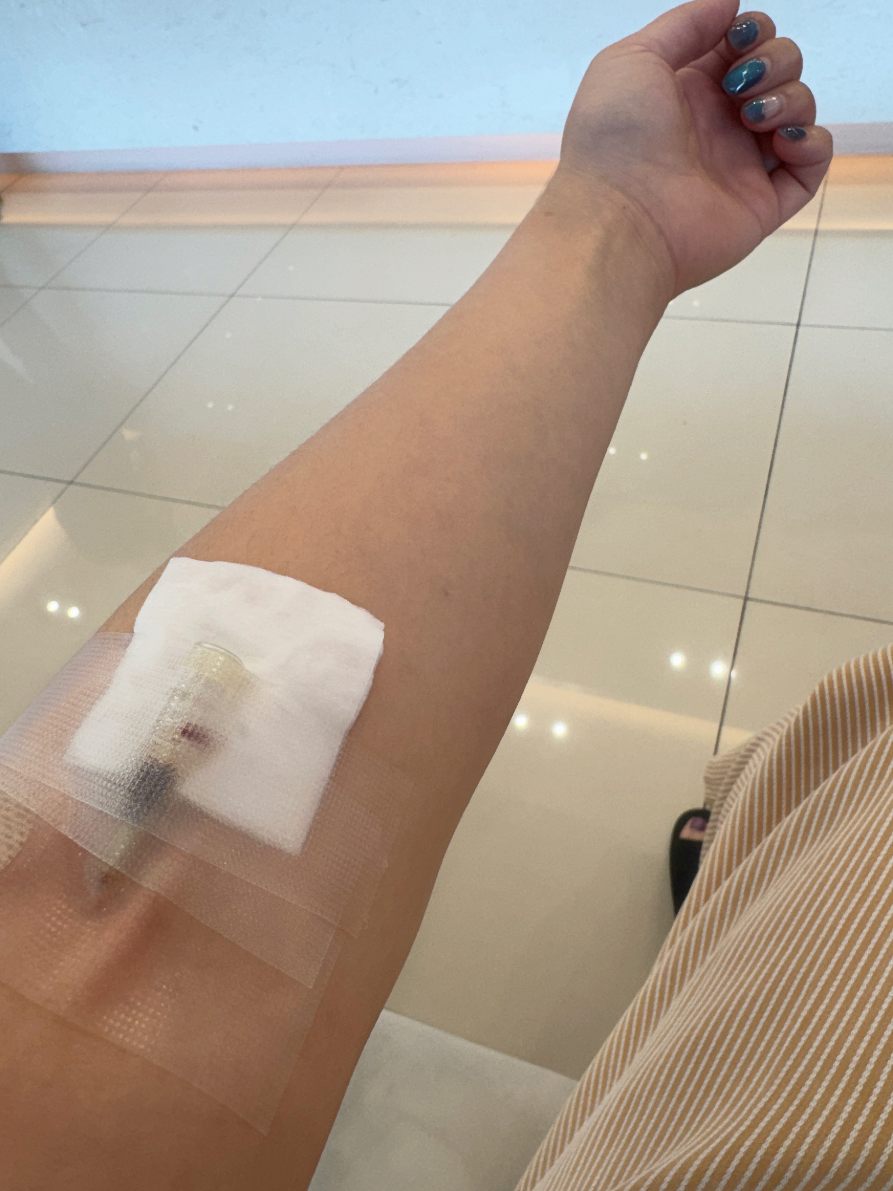 건강검진 수면내시경 전 팔에 주사 바늘이 꽂힌 모습