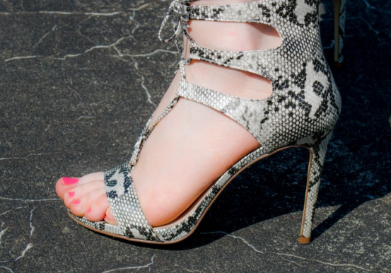 지간신경염-원인