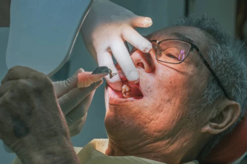 차상위 임플란트 지원 9