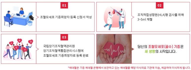 조혈모세포기증절차