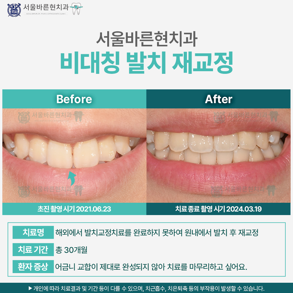 해운대교정치과