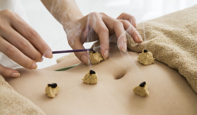 쑥의 활용법중 쑥뜸에 대한 이해를 돕기위한 쑥뜸이미지.