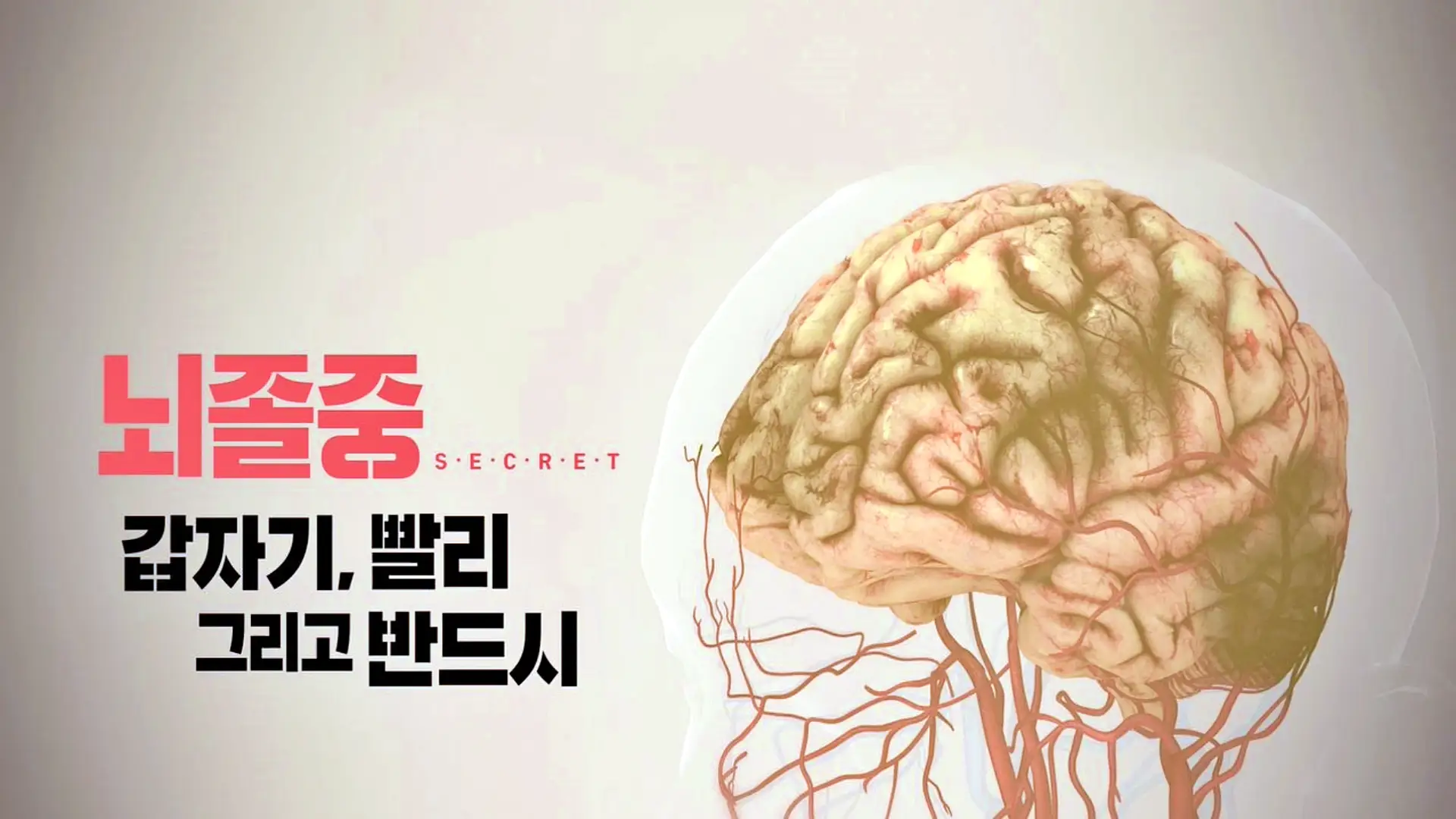 KBS 생로병사의 비밀 835회 뇌졸중 치료, 후유증, 뇌동맥류 검사 예방법 방법 오늘방송 다시보기 정보