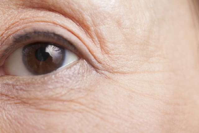 눈밑꺼짐, 눈밑주름 없애는 방법! 눈밑지방 없애는 마사지 TIP