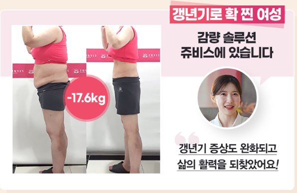 쥬비스다이어트 후기