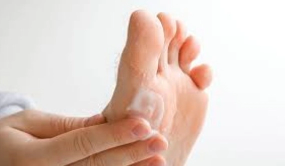 무좀 피부과 비용 정리