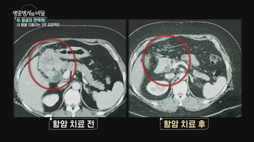생로병사 영상이미지
