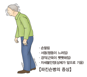 파킨슨병-초기증상-치료방법