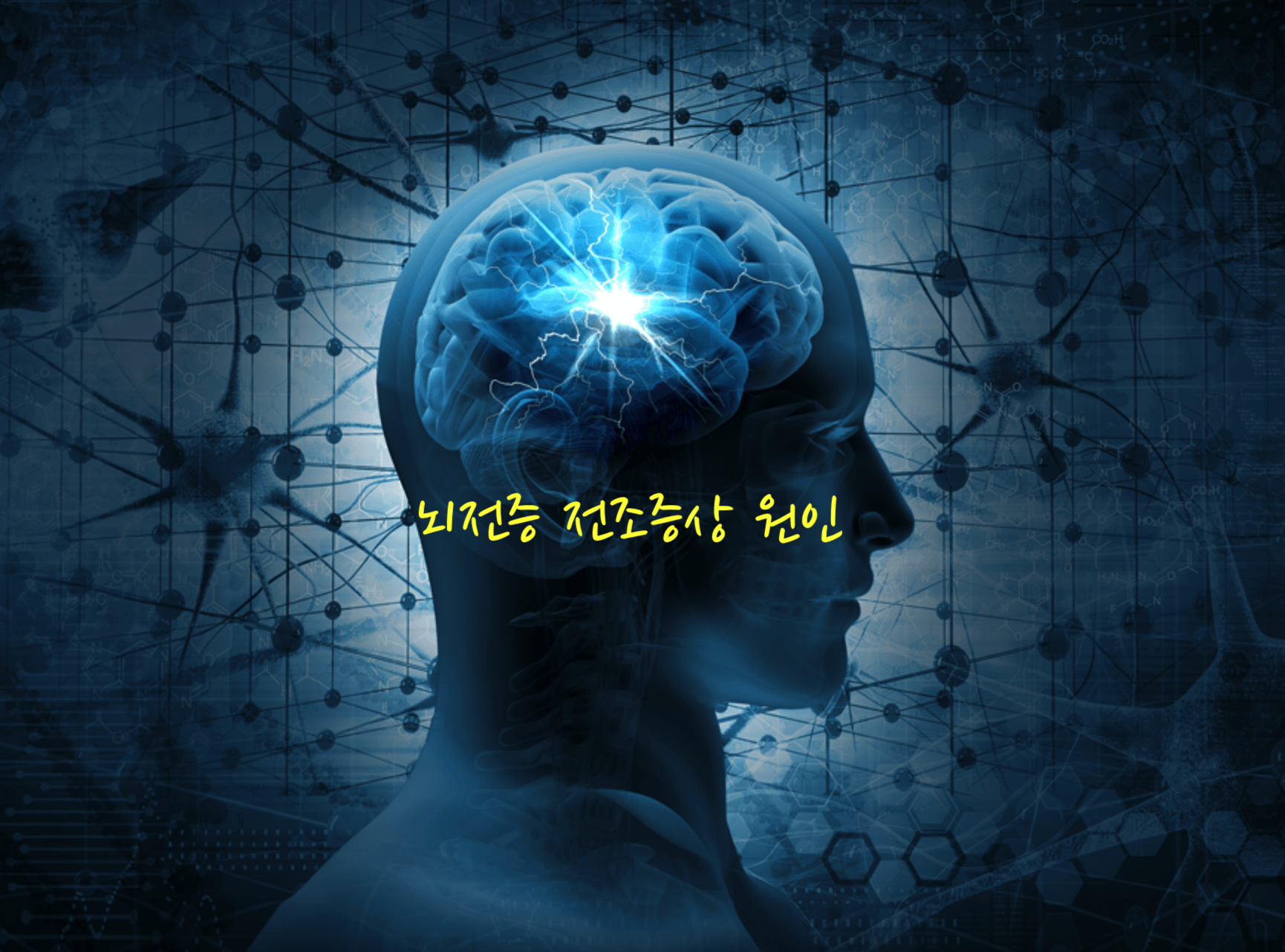 뇌전증