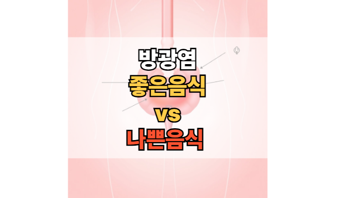 방광염-좋은-음식-피해야-하는-음식