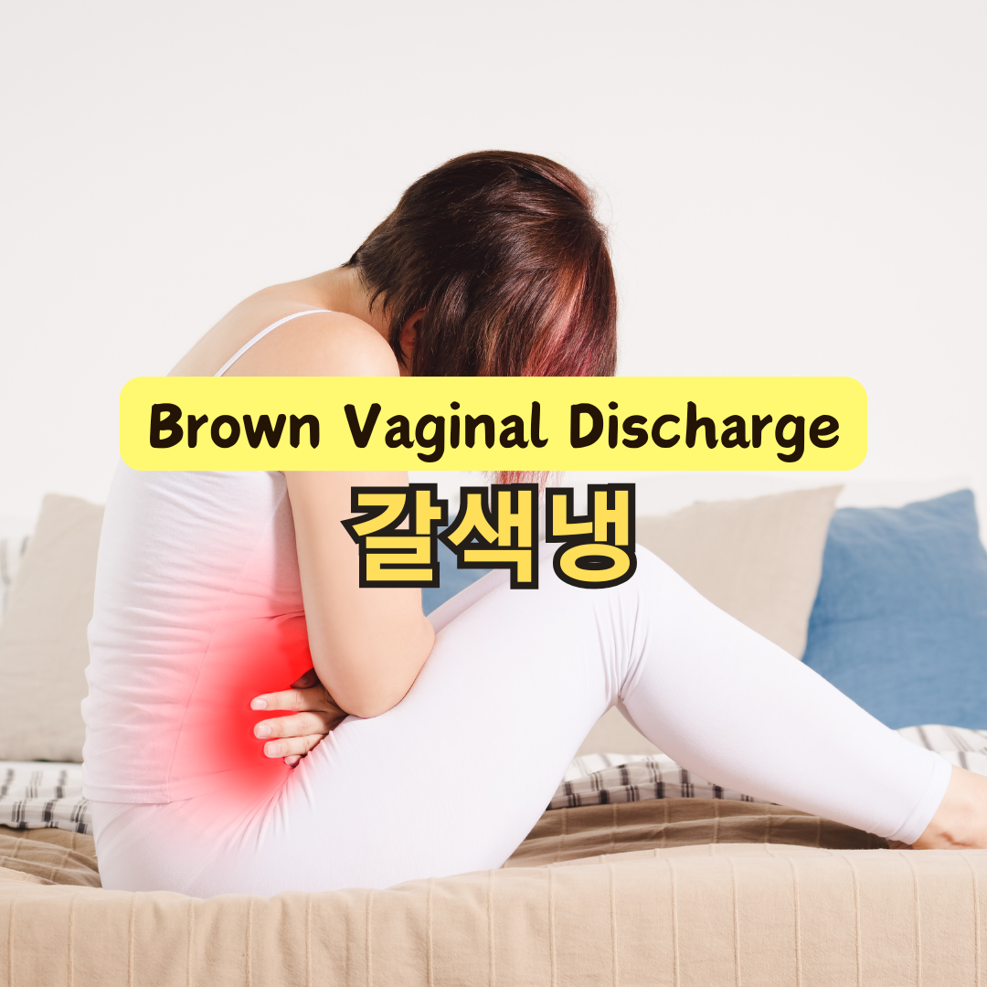 갈색냉 원인과 예방법