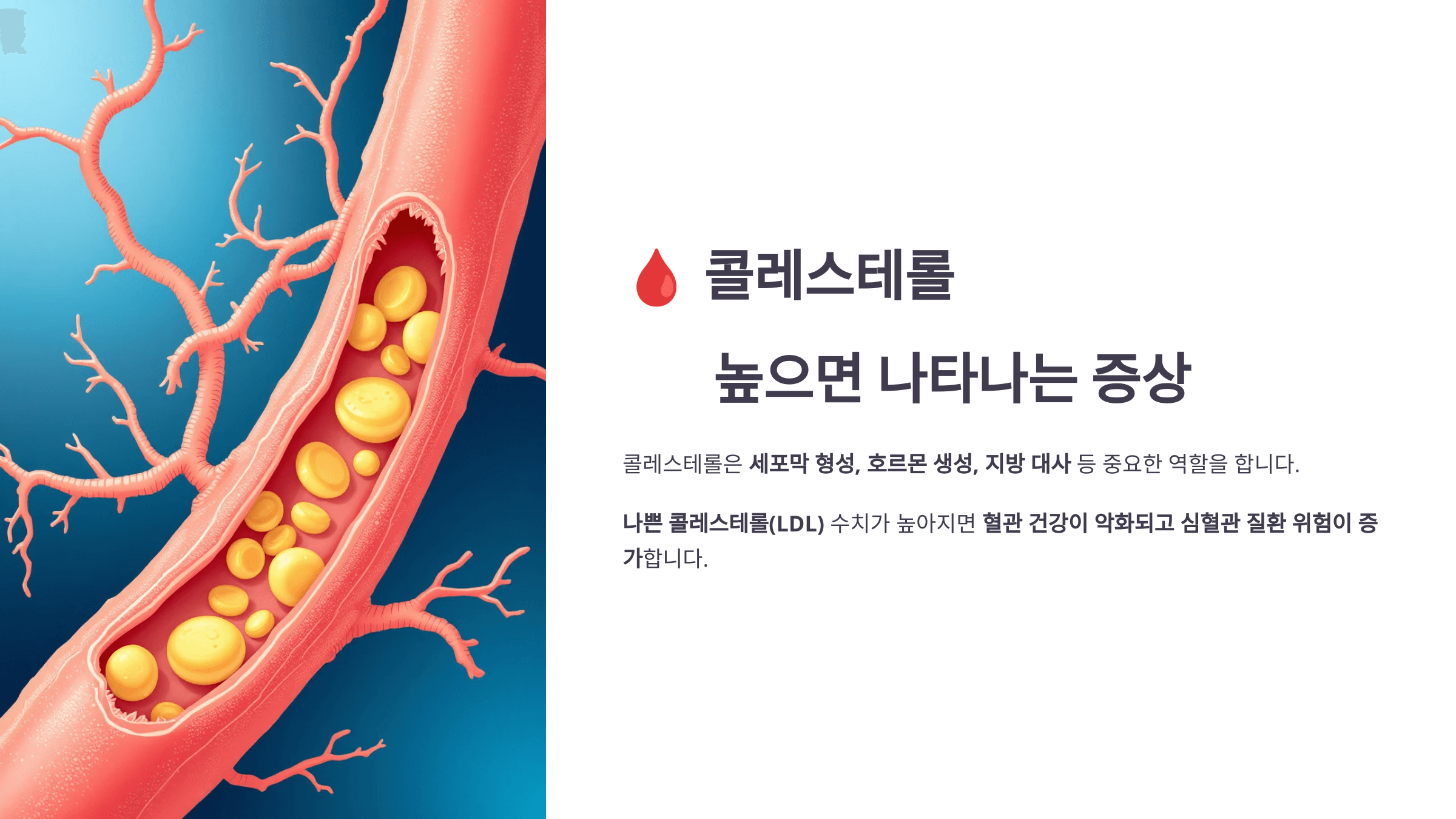 콜레스테롤과 관련된 사진입니다.
