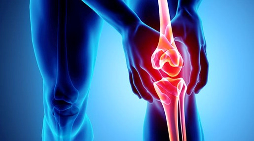 무릎 관절염 증상 치료법 및 무릎 관절염에 좋은 운동 추천