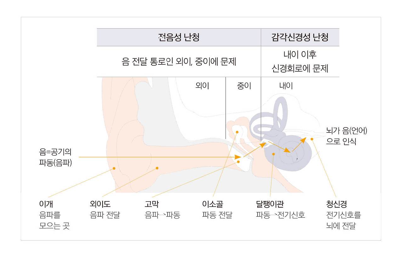 히어닷컴(Hear.com)보청기 1달 무료 체험 후기 제8화