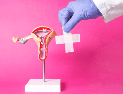 자궁근종 증상 7가지, 수술후 회복기간