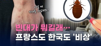 쯔쯔가무시병의 증상과 치료