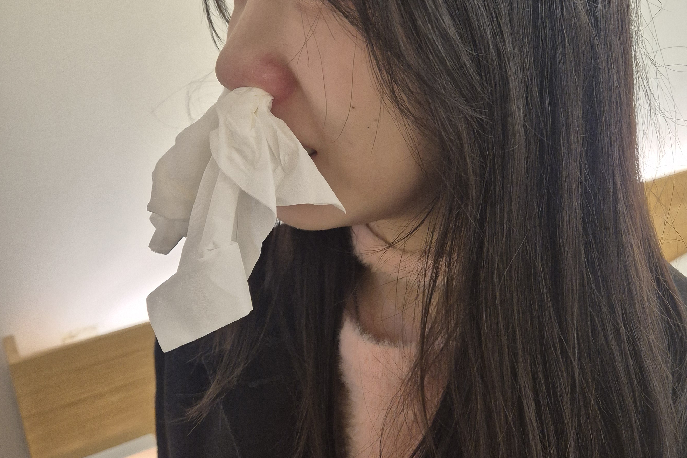 알레르기 비염 심할 때 증상, 게시글 주인공의 코막힘 재채기 비염 증상 이미지