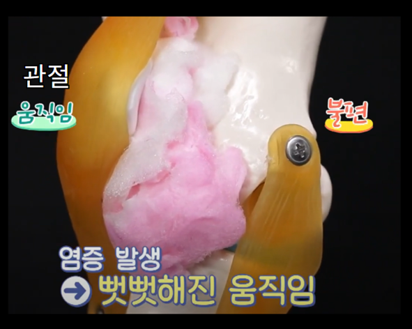 천심련 추출물 파렉틴 - 관절 염증 완화