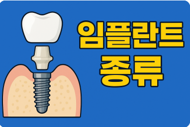 임플란트 종류