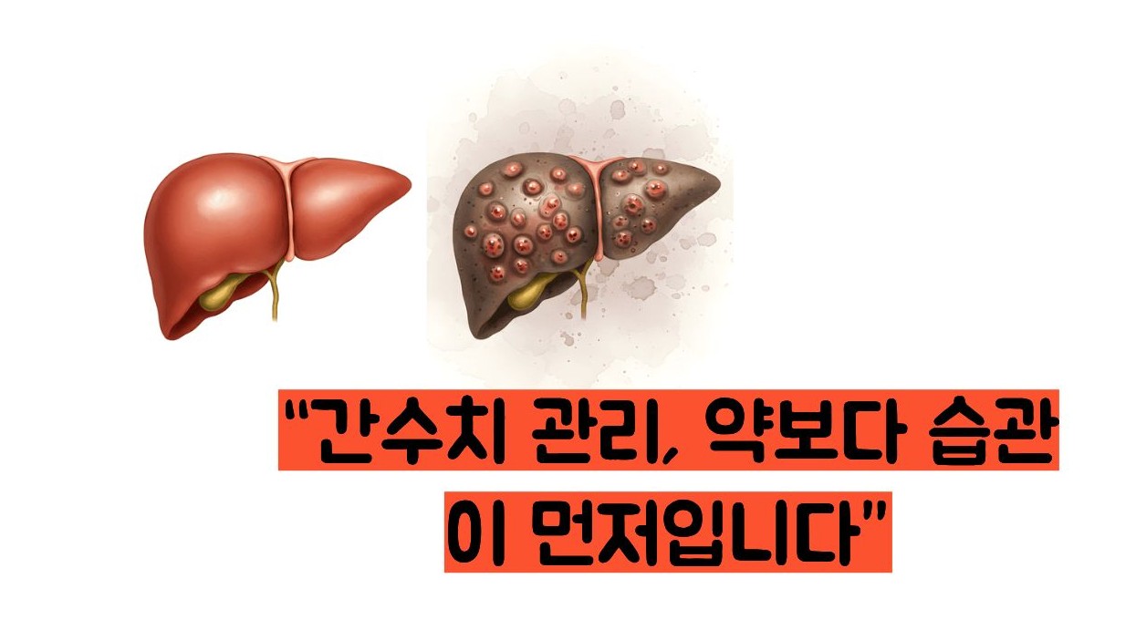 간수치 내리는 방법