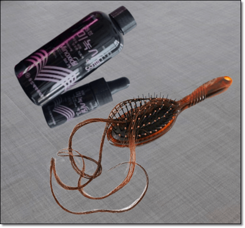 미녹시딜 탈모 예방 효과