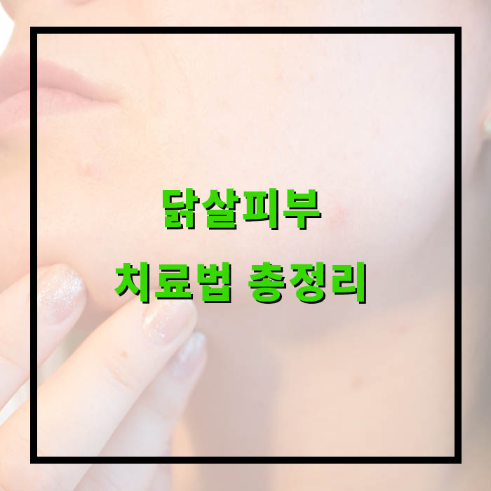 모공 각화증 치료, 원인, 로션 추천