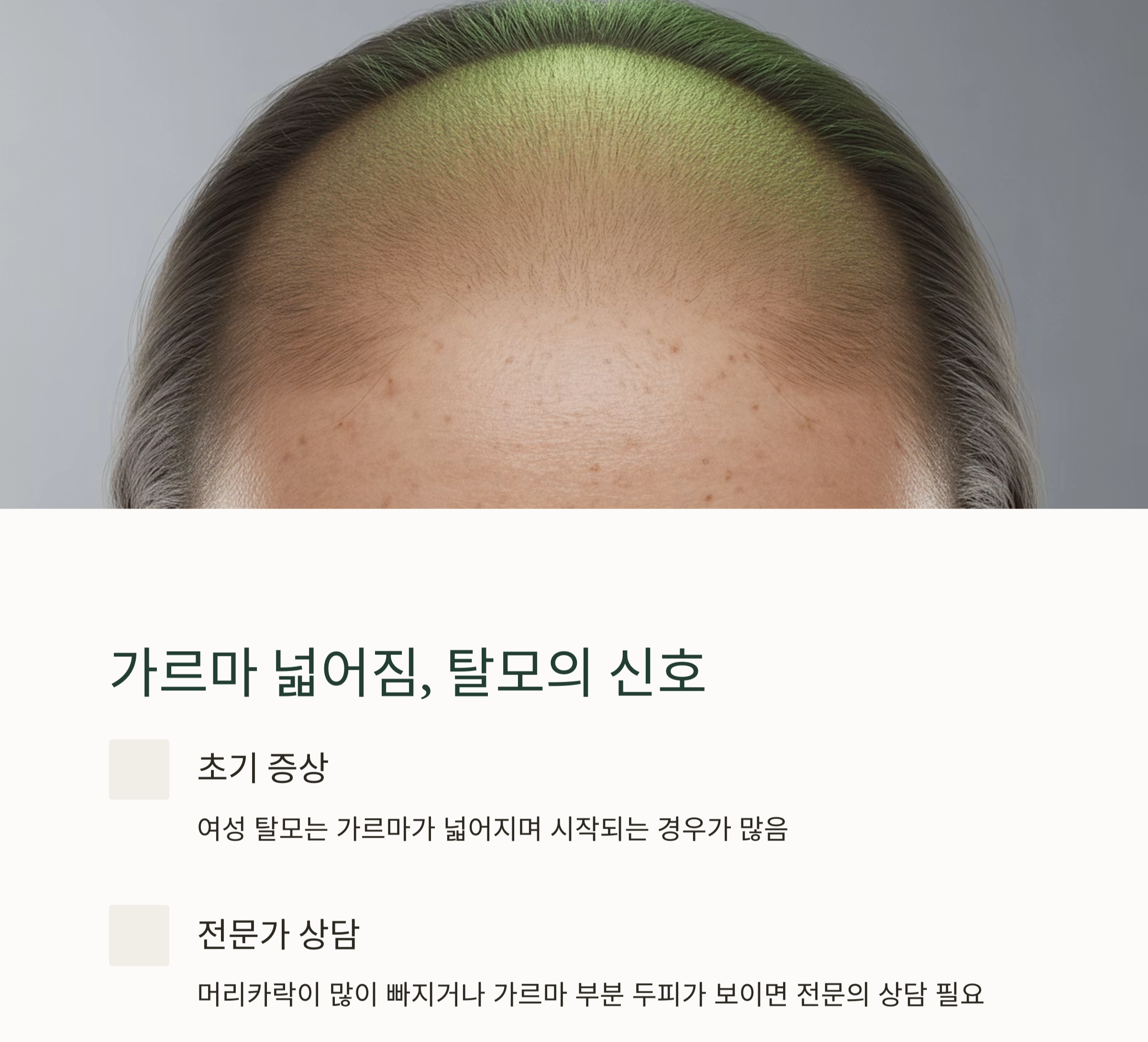 여성 탈모 초기 대응, 관리법만 알면 두피도 되살아납니다
