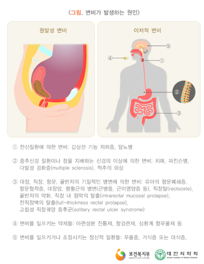 대장흑생증의 원인/ 출처 - 보건복지부 & 대한의학회