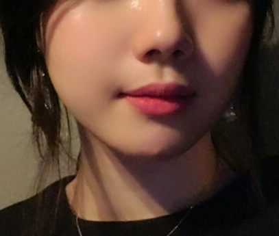 코조각주사 후기