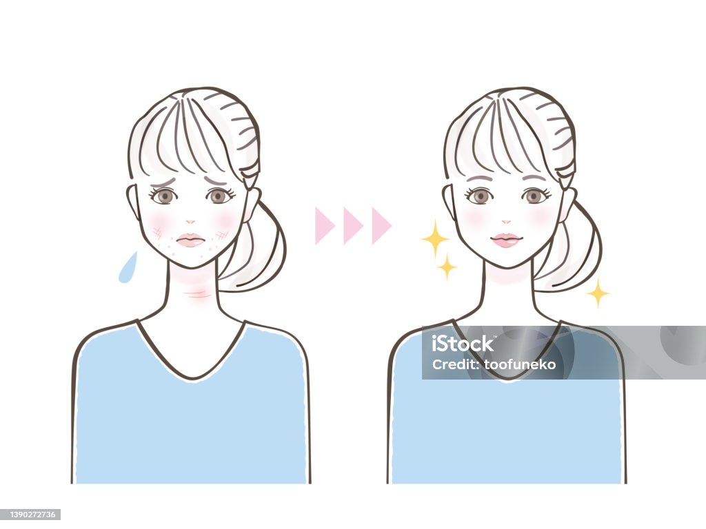 기미와 흑자는 다르다 하지만 둘 다 피부에 보기 싫은 흔적이라는 점은 같다