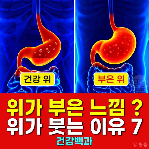 위가 부은 느낌 위가 붓는 이유