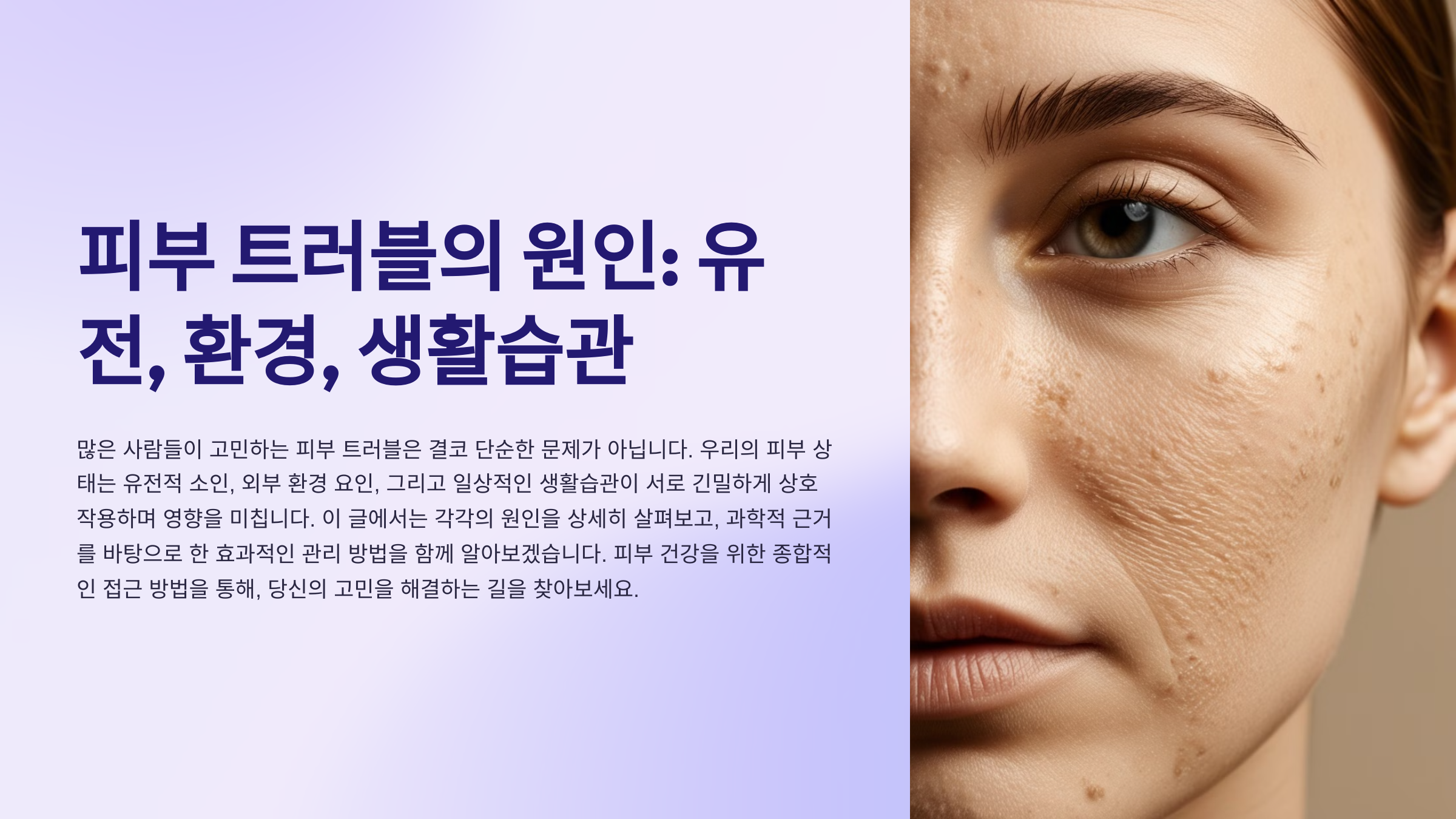 피부 트러블의 원인: 유전, 환경, 생활습관