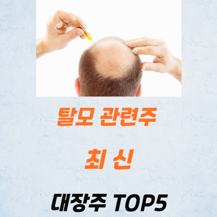 탈모 관련주 대장주 테마주 수혜주 TOP5