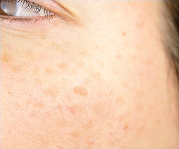 도미나 크림 사용법